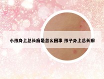 小孩身上总长癣是怎么回事 孩子身上总长癣