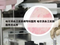 哈尔滨永江皮肤病专科医院 哈尔滨永江皮肤医院怎么样