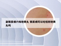 副银屑病六味地黄丸 银屑病可以吃桂附地黄丸吗