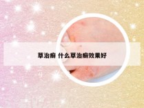 草治癣 什么草治癣效果好