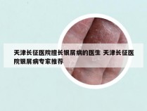天津长征医院擅长银屑病的医生 天津长征医院银屑病专家推荐