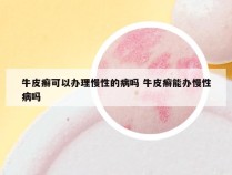 牛皮癣可以办理慢性的病吗 牛皮癣能办慢性病吗