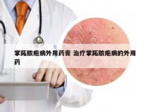 掌跖脓疱病外用药膏 治疗掌跖脓疱病的外用药