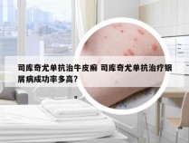司库奇尤单抗治牛皮癣 司库奇尤单抗治疗银屑病成功率多高?