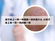 孩子身上一块一块像癣一样的是什么 小孩子身上有一块一块的癣一样
