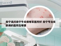 南宁请问南宁牛皮癣哪家医院好 南宁专治皮肤病的医院在哪里