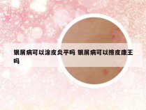 银屑病可以涂皮炎平吗 银屑病可以擦皮康王吗