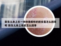 新生儿身上长一块块像癣样的脱皮是怎么回事呢 新生儿身上有皮怎么回事