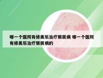 哪一个医院有修美乐治疗银屑病 哪一个医院有修美乐治疗银屑病的