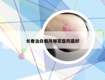 长春治白癜风哪家医院最好