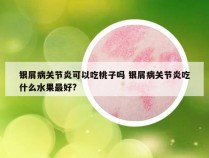 银屑病关节炎可以吃桃子吗 银屑病关节炎吃什么水果最好?