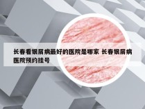 长春看银屑病最好的医院是哪家 长春银屑病医院预约挂号