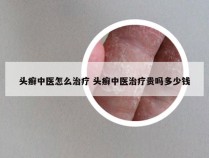 头癣中医怎么治疗 头癣中医治疗贵吗多少钱