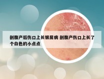 剖腹产后伤口上长银屑病 剖腹产伤口上长了个白色的小点点
