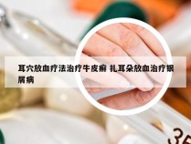 耳穴放血疗法治疗牛皮癣 扎耳朵放血治疗银屑病