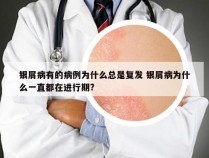 银屑病有的病例为什么总是复发 银屑病为什么一直都在进行期?