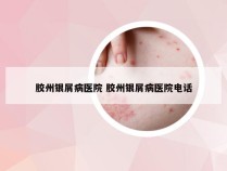 胶州银屑病医院 胶州银屑病医院电话