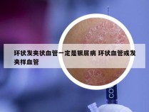 环状发夹状血管一定是银屑病 环状血管或发夹样血管