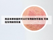 西昌有那些医院可以打生物制剂可善挺 可善挺生物制剂效果