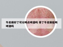 牛皮癣好了可以喝点啤酒吗 得了牛皮癣能喝啤酒吗