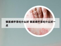 银屑病平常吃什么好 银屑病平常吃什么好一点