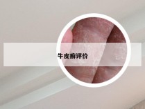 牛皮癣评价