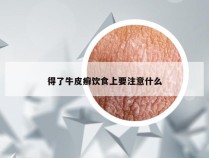 得了牛皮癣饮食上要注意什么