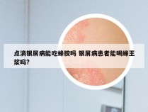 点滴银屑病能吃蜂胶吗 银屑病患者能喝蜂王浆吗?