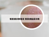 银屑病诊断错误 银屑病临床诊断