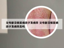 父母都没银屑病孩子发病率 父母都没银屑病孩子发病率高吗