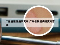 广东省银屑病研究所 广东省银屑病研究所官网