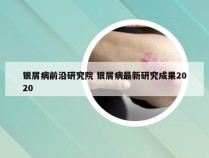 银屑病前沿研究院 银屑病最新研究成果2020