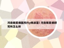 河南银屑病医院约y杨淑莲l 河南银屑病研究所怎么样