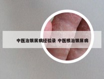 中医治银屑病经验录 中医根治银屑病