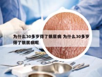 为什么30多岁得了银屑病 为什么30多岁得了银屑病呢