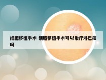 细胞移植手术 细胞移植手术可以治疗淋巴癌吗