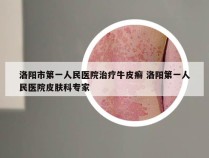 洛阳市第一人民医院治疗牛皮癣 洛阳第一人民医院皮肤科专家