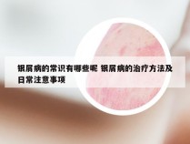 银屑病的常识有哪些呢 银屑病的治疗方法及日常注意事项