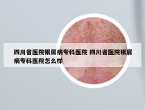 四川省医院银屑病专科医院 四川省医院银屑病专科医院怎么样