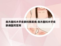 南方医科大学皮肤科银屑病 南方医科大学皮肤病医院官网