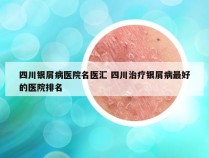 四川银屑病医院名医汇 四川治疗银屑病最好的医院排名