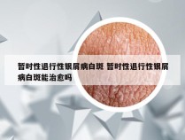 暂时性退行性银屑病白斑 暂时性退行性银屑病白斑能治愈吗