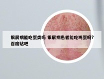 银屑病能吃蛋类吗 银屑病患者能吃鸡蛋吗?百度贴吧