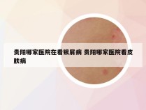 贵阳哪家医院在看银屑病 贵阳哪家医院看皮肤病