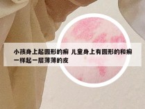 小孩身上起圆形的癣 儿童身上有圆形的和癣一样起一层薄薄的皮
