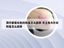 满手都是白色的斑是怎么回事 手上有大片白斑是怎么回事