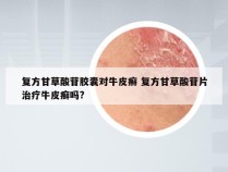 复方甘草酸苷胶囊对牛皮癣 复方甘草酸苷片治疗牛皮癣吗?