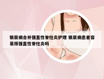 银屑病合并强直性脊柱炎护理 银屑病患者容易得强直性脊柱炎吗