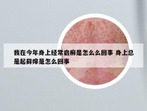 我在今年身上经常启癣是怎么么回事 身上总是起藓痒是怎么回事