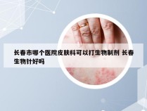 长春市哪个医院皮肤科可以打生物制剂 长春生物针好吗